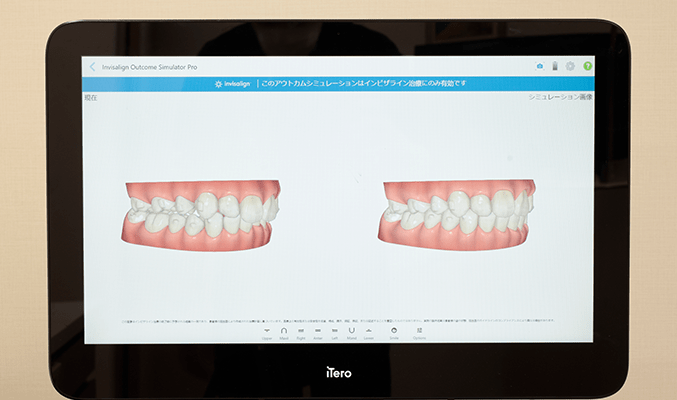 mouth9
